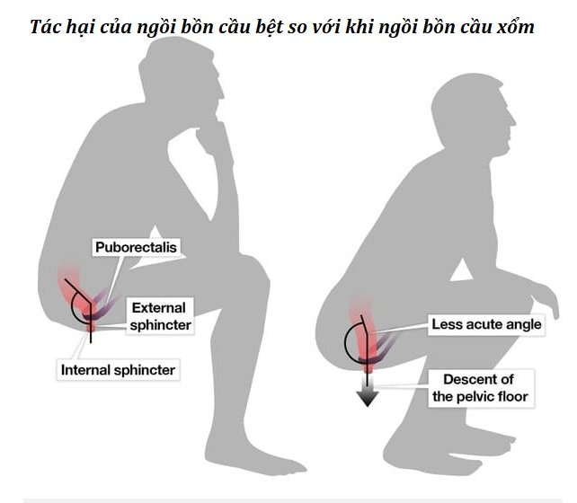 uu-nhuoc-diem-cua-tu-the-ngoi-ban-cau